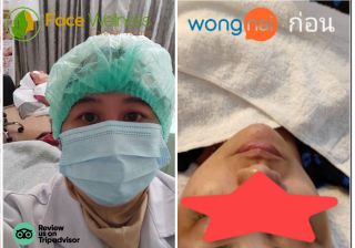 You can massage your face, you can make your face healthy